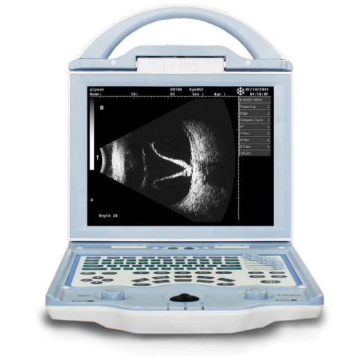 Full Digital Laptop Ophthalmic Ultrasound Ab Scan Machine