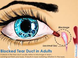 Eye disease treatment and management