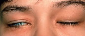Common eye problems and their symptoms
