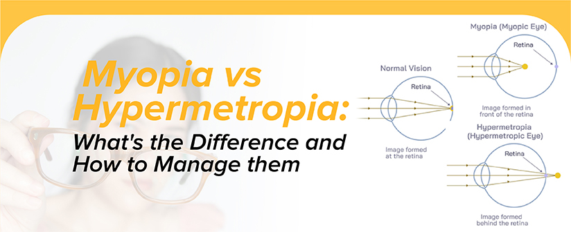 Myopia vs. Hypermetropia: What’s the Difference and How to Manage Them?
