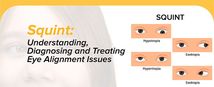 Squint: Understanding, Diagnosing, and Treating Eye Alignment Issues