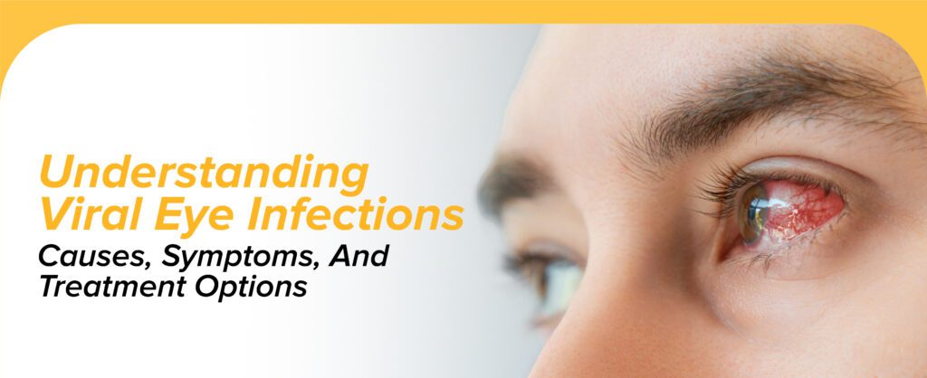 Understanding Viral Eye Infections: Causes, Symptoms, And Treatment Options