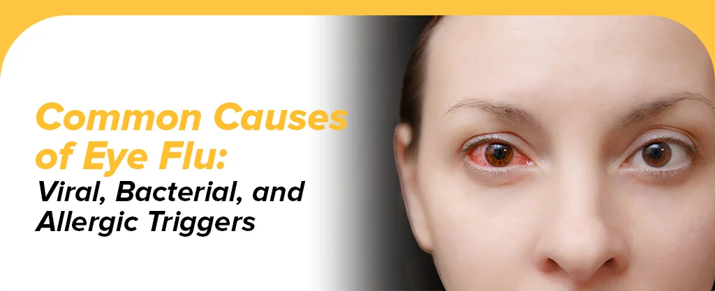 Common Causes Of Eye Flu: Viral, Bacterial, And Allergic Triggers
