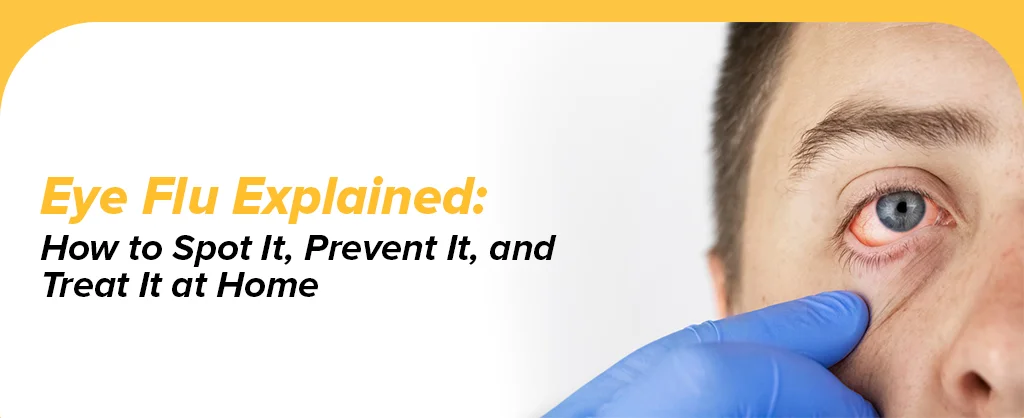 Eye Flu Explained: How To Spot It, Prevent It, And Treat It At Home