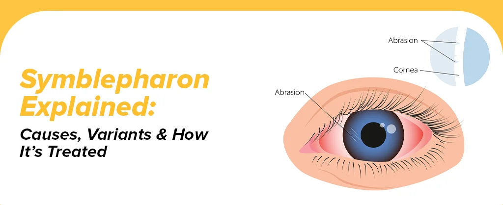 Symblepharon Explained: Causes, Variants & How It’s Treated