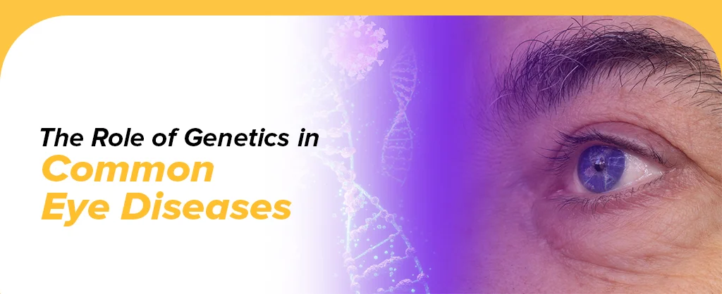The Role Of Genetics In Common Eye Diseases
