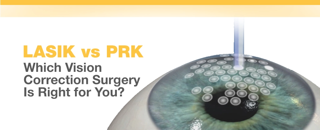 LASIK vs PRK: Which Vision Correction Surgery Is Right for You?