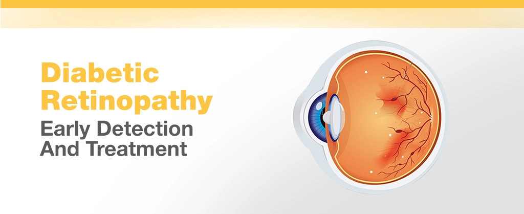 Diabetic Retinopathy: Early Detection And Treatment